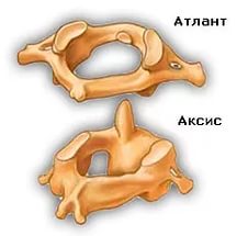 Атлант и аксис шейного отдела позвоночника