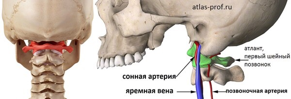 Атлант и аксис шейного отдела позвоночника thumbnail